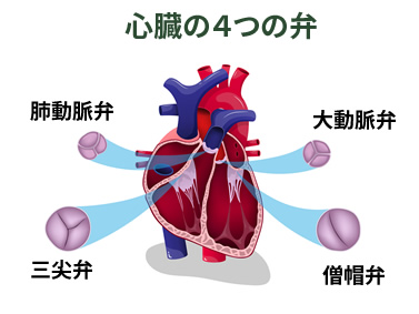 閉塞性動脈硬化症
